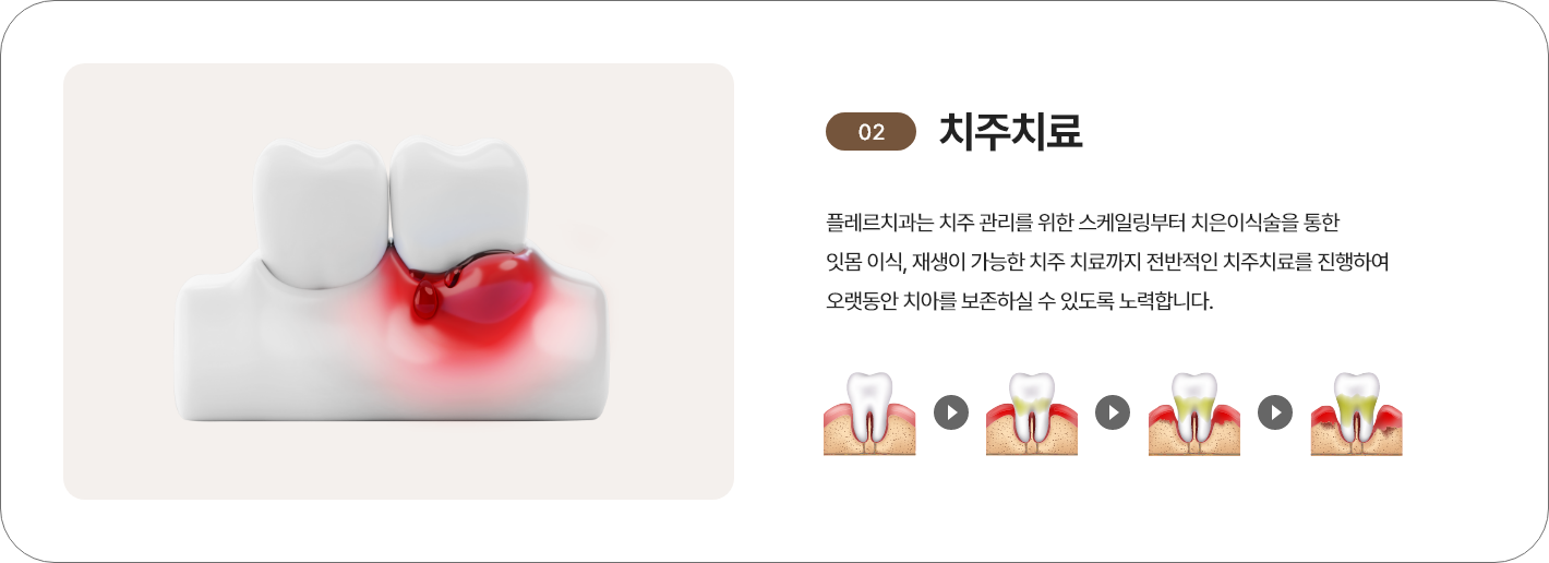 치주치료